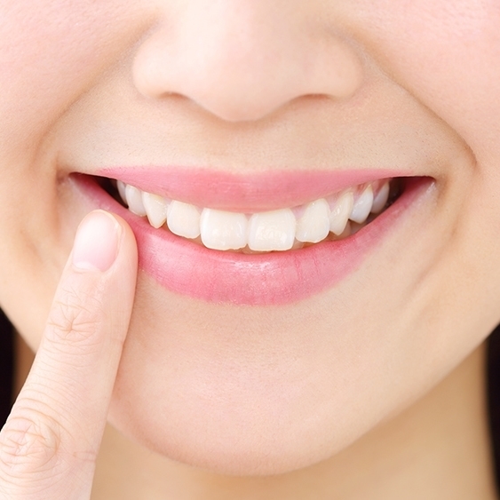 歯の矯正後に笑顔を見せる女性の口元