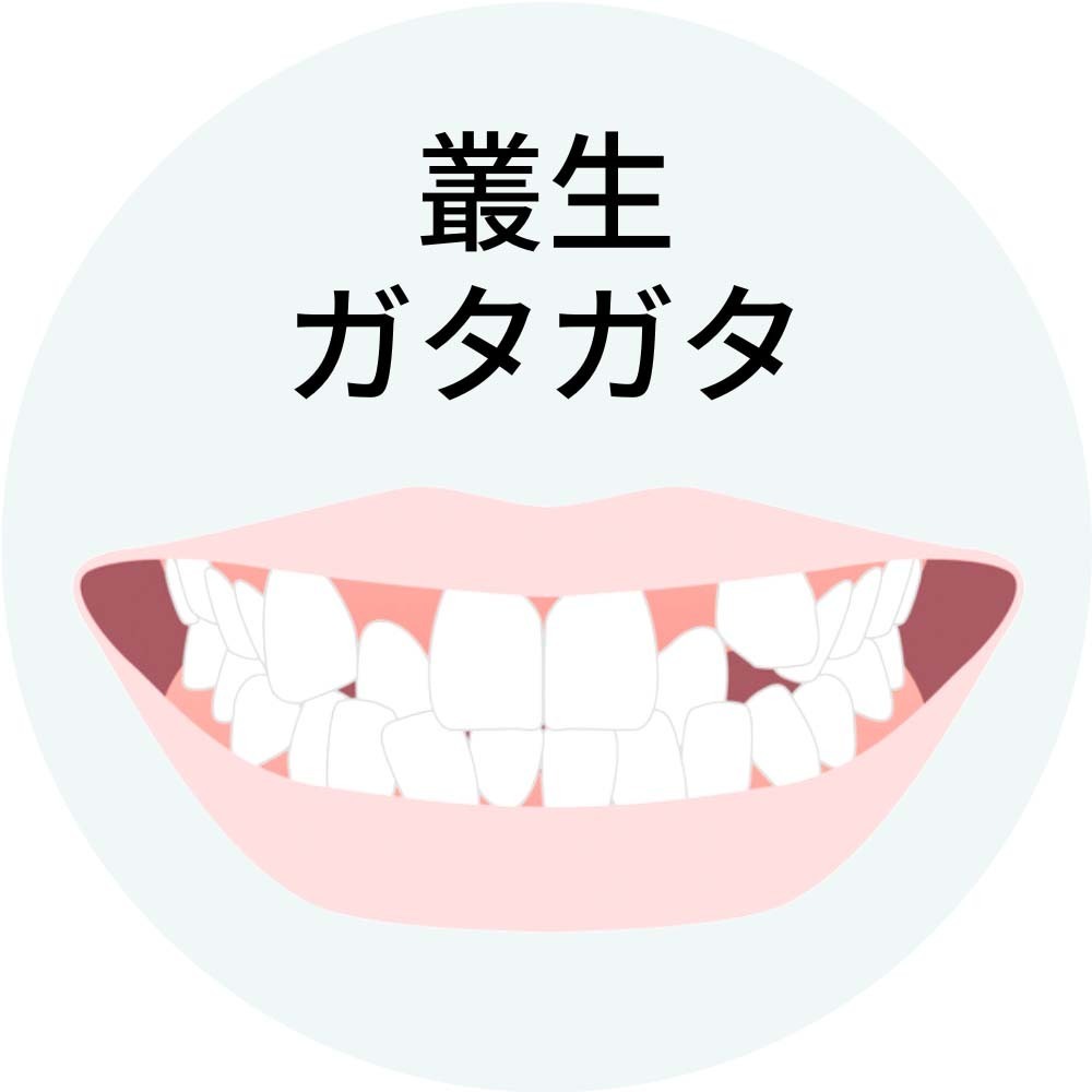 叢生・ガタガタ