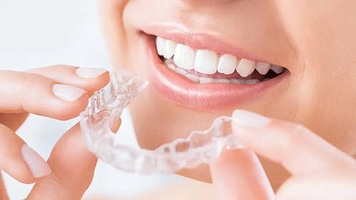 大村の歯科矯正で人気を集めるおすすめの透明なマウスピース矯正装置