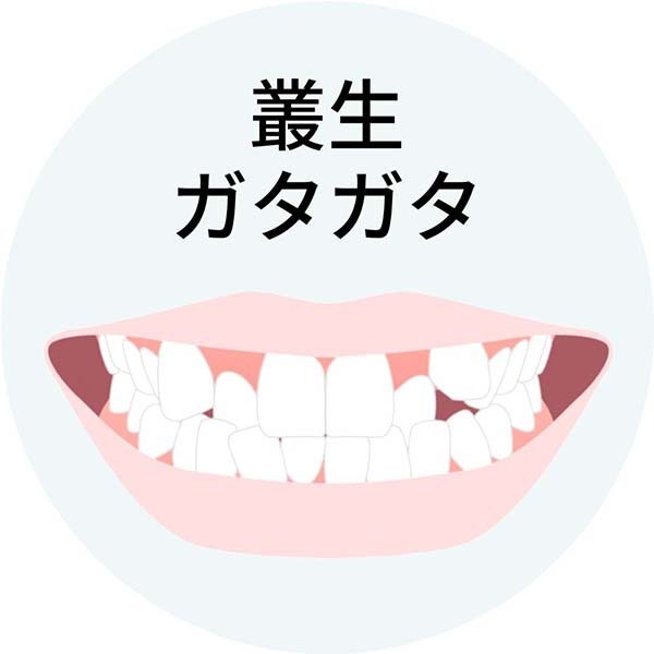 叢生・ガタガタ