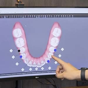 治療計画を患者に説明する矯正担当医