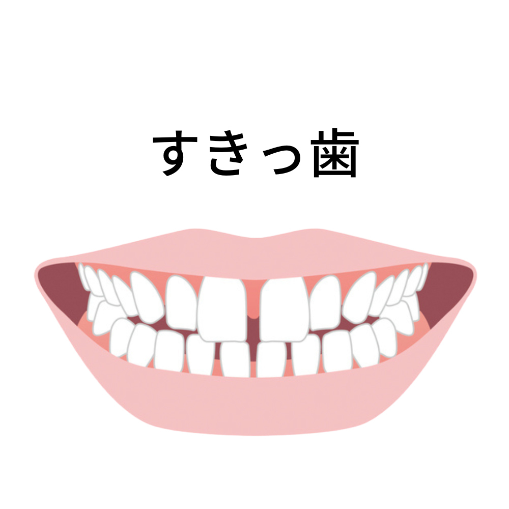 ＡＩの扱いで失敗のリスクが生じる