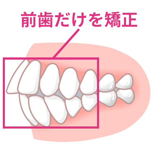 ＡＩの扱いで失敗のリスクが生じる